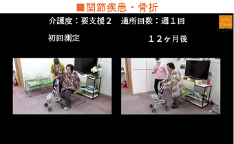 関節疾患・骨折