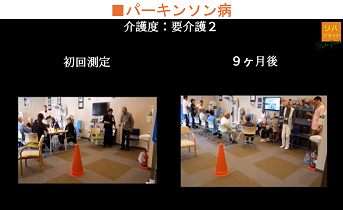 パーキンソン病